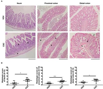 Mucosal Exposure to Cigarette Components Induces Intestinal Inflammation and Alters Antimicrobial Response in Mice